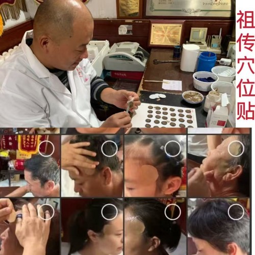 针脉仁心李东兰：聊城六代中医世家的“十五五”传承新篇
