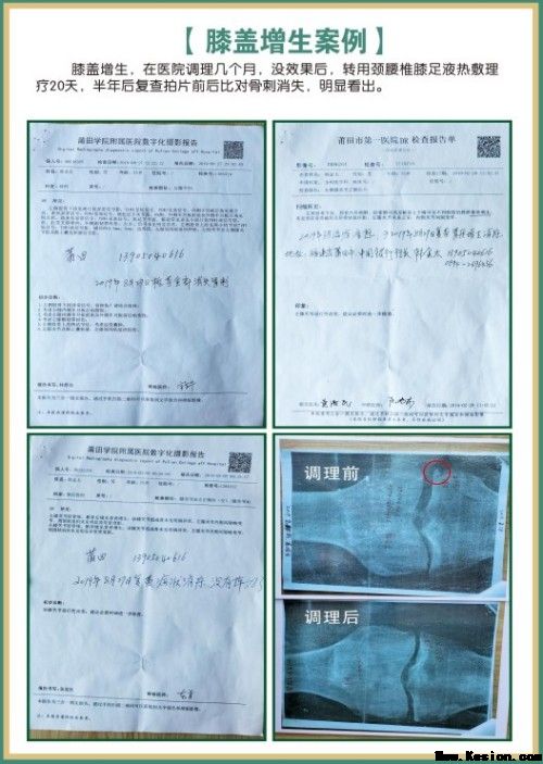 礼赞八一专题报道 著名国医大师---杨宗仙