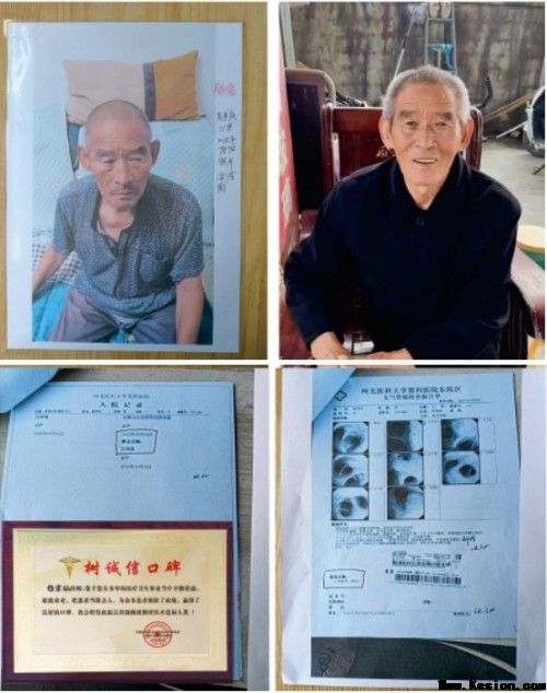 礼赞八一专题报道 著名国医大师---杨宗仙
