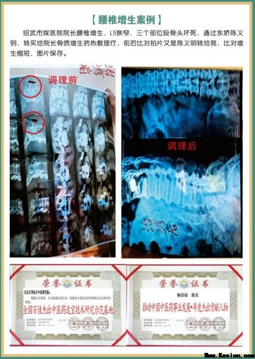 礼赞八一专题报道 著名国医大师---杨宗仙