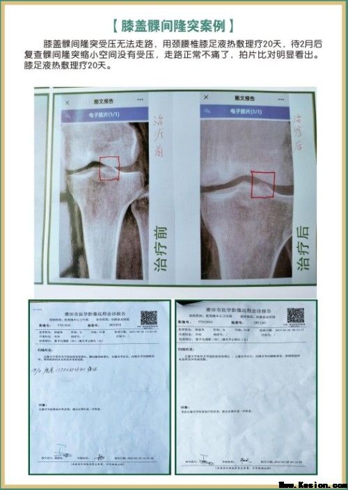 礼赞八一专题报道 著名国医大师---杨宗仙