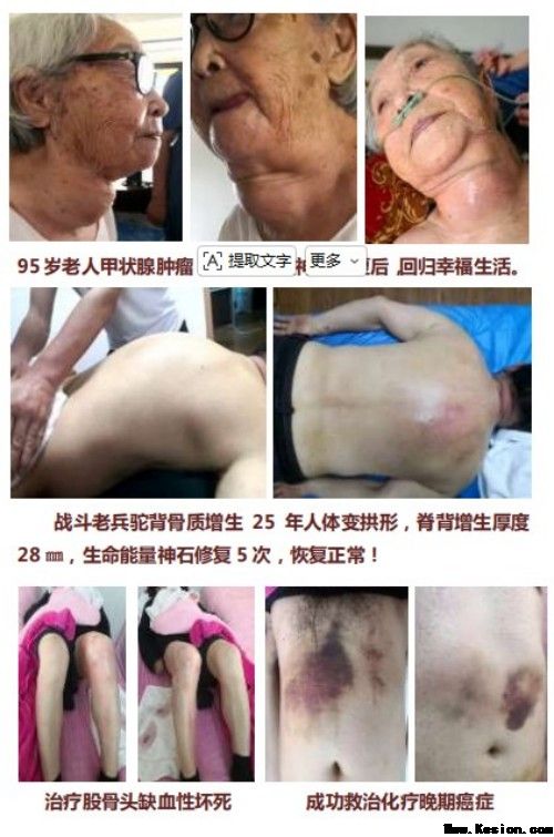 生命能量神石荣获国家科技成果奖，开启能量医学养生新征程