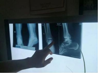 大医精诚 悬壶济世——整骨专家生茂东