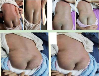 2024新春献礼专题报道 著名瑶医银疗推拿专家——周继辉