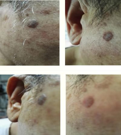 中国新时代大健康引领者 量子氢氧健康第一人长寿哥（廖永贵）