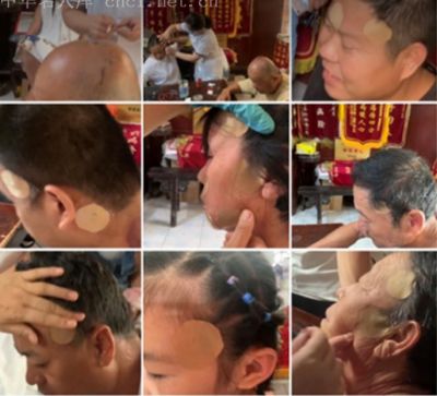 【观两会 论健康】   特别报道 头痛、头晕、三叉神经痛病专家——李东兰