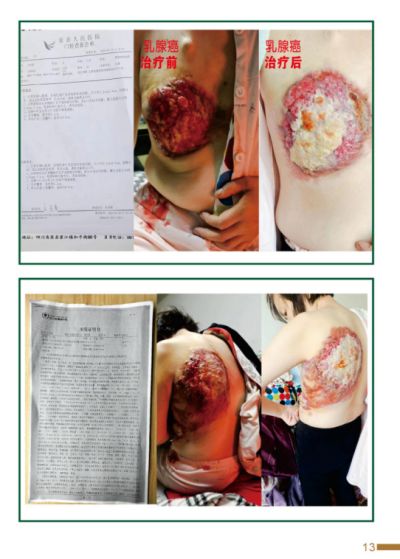 2024新春献礼专题报道 新时代国医名师---杨宗仙