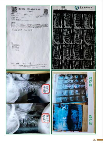 贯彻落实两会精神 访新时代国医名师---杨宗仙