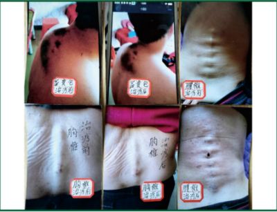 贯彻落实两会精神 访新时代国医名师---杨宗仙