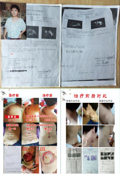 贯彻落实两会精神 访新时代国医名师---杨宗仙