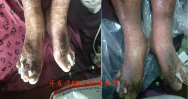 2025喜迎新春特别报道 中医骨膜消结术创始人---潘杏富