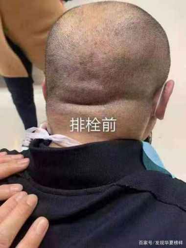 喜迎二十大·专题报道中国当代名中医—赵家为