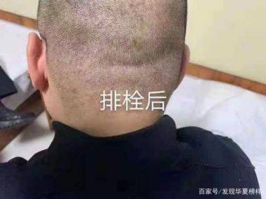 喜迎二十大·专题报道中国当代名中医—赵家为