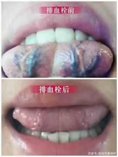 喜迎二十大·专题报道中国当代名中医—赵家为