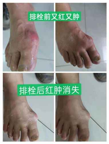 喜迎二十大·专题报道中国当代名中医—赵家为