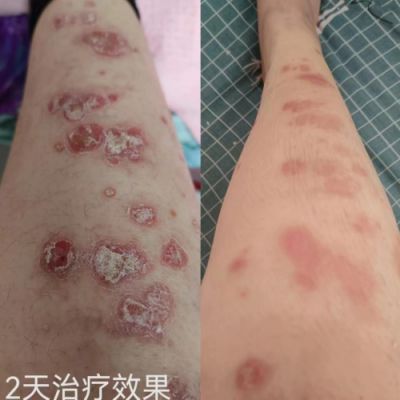 承千年文化 扬中医德馨 特别报道 著名皮肤病专家——闫绍军