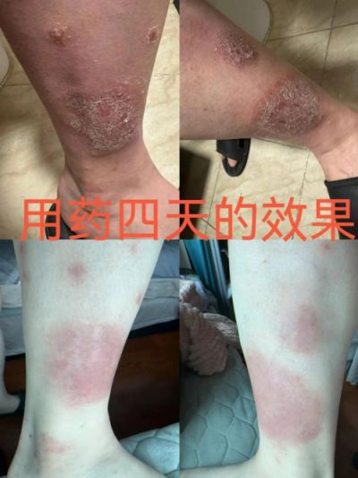 承千年文化 扬中医德馨 特别报道 著名皮肤病专家——闫绍军