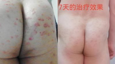 承千年文化 扬中医德馨 特别报道 著名皮肤病专家——闫绍军