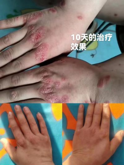 承千年文化 扬中医德馨 特别报道 著名皮肤病专家——闫绍军