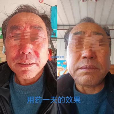 承千年文化 扬中医德馨 特别报道 著名皮肤病专家——闫绍军