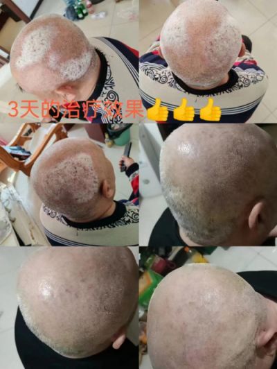 承千年文化 扬中医德馨 特别报道 著名皮肤病专家——闫绍军