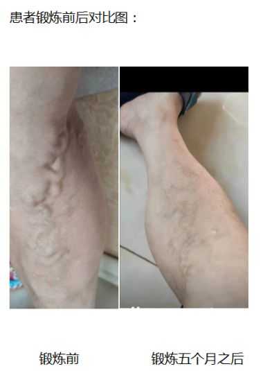 气脉骨雕22代传承人——陈欣（陈樊宇）