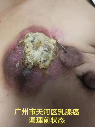 中国湘西苗医陈氏祖传秘方民间地产中草药技术---陈海峰